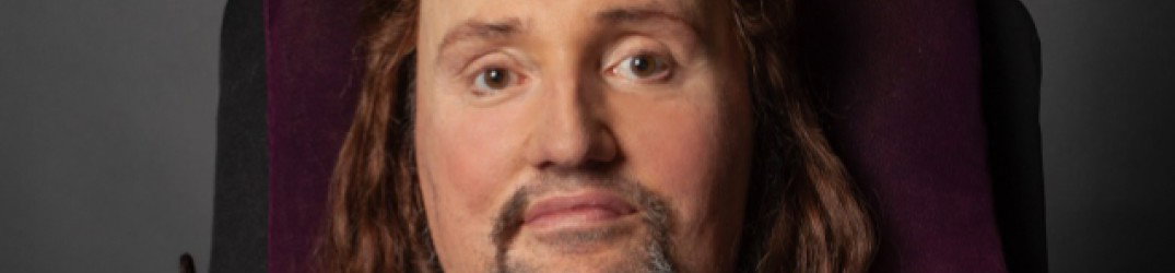 Jason Becker: la madre, 'L'operazione è andata bene'